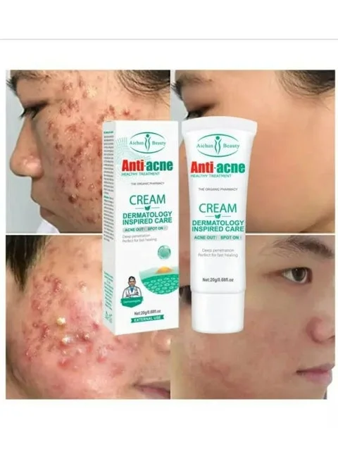Crème Anti-acnés, élimine les boutons, les comédons , les peaux grasses et l'aspect huilé du visagela , Crème Anti-acné de la marque Aichun Beauty, un soin visage présenté en tube de 20 g. FC