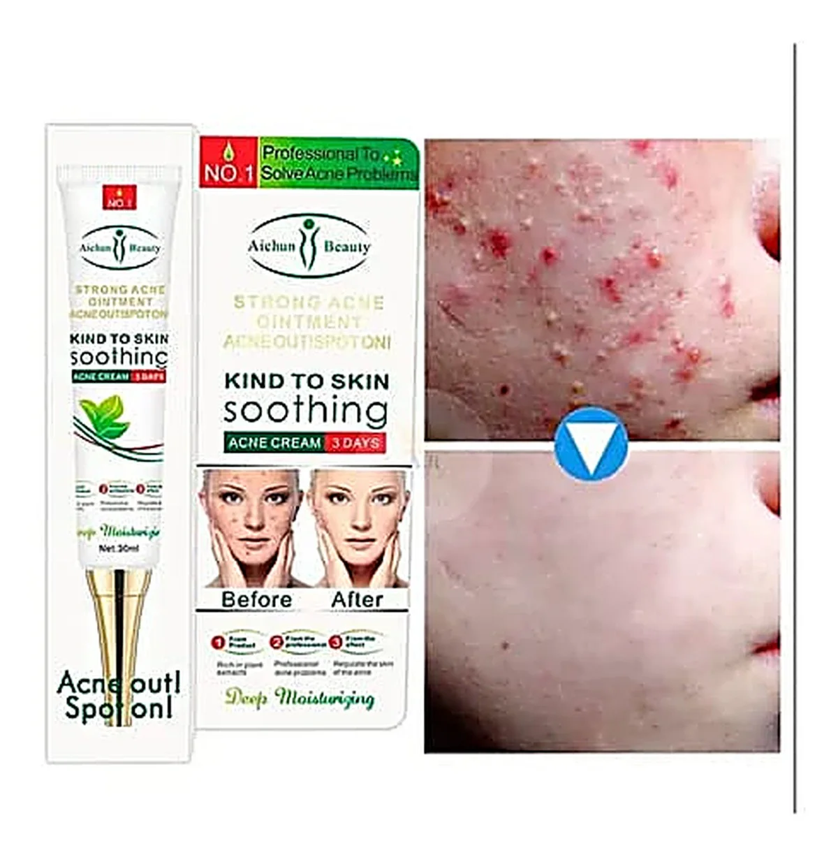 Crème anticernes, anti-poches, anti-rides éclaicissante Anti-Acné Aichun Beauty — Soin Dermatologique aux Extraits de Plantes, Tube 20g