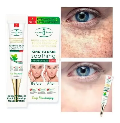 Crème anticernes, anti-poches, anti-rides éclaicissante Anti-Acné Aichun Beauty — Soin Dermatologique aux Extraits de Plantes, Tube 20g