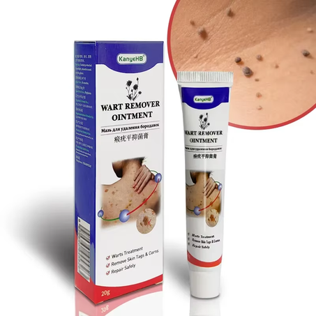 Senwart™ – Crème Puissante Anti-Verrues | Élimine Cors, Verrues & Papillomes Rapidement