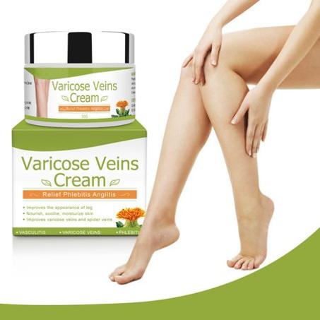 Varicose Veins Cream كريم توسع الاوردة