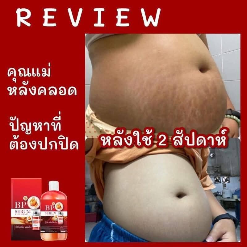 سيروم الطماطم للتبيض وعلاج التشققات الحمراء والبيضاء