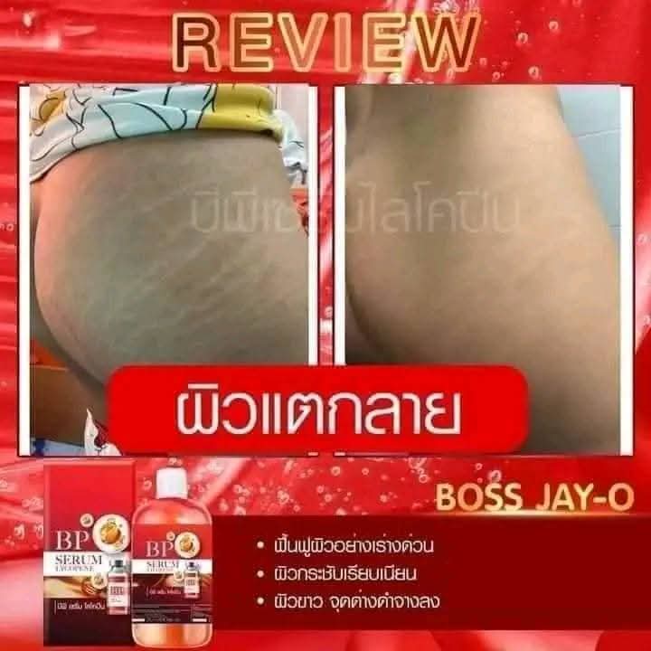 سيروم الطماطم للتبيض وعلاج التشققات الحمراء والبيضاء
