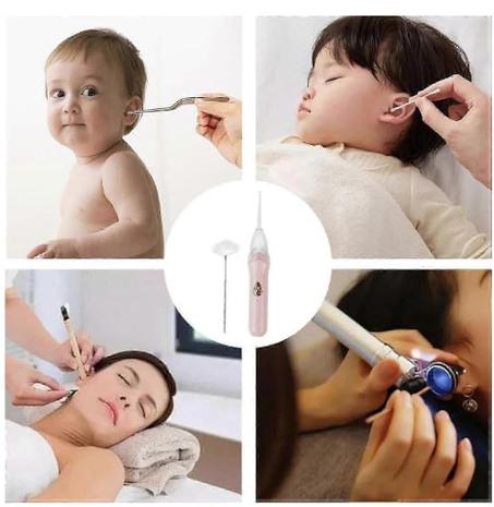 "✨ Nettoyez vos oreilles en toute sécurité – Le dispositif intelligent pour une hygiène parfaite ! ✨"