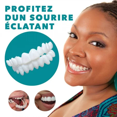 Facettes dentaires temporaire