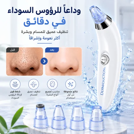 جهاز لشفط و إزالة الرؤوس السوداء