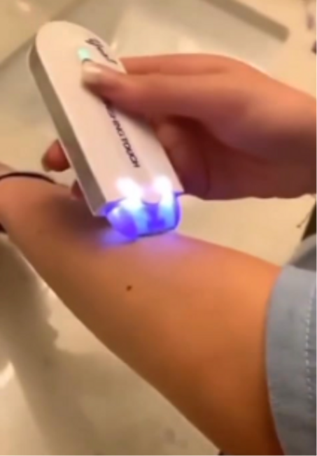 مزيل شعر الاصلي