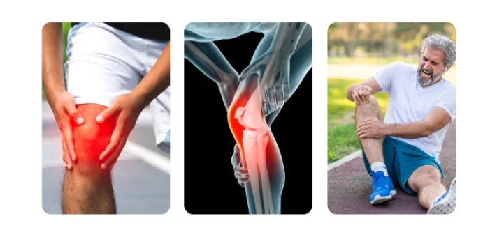 ضماضات آلام الركبة SPORTS KNEE BRACE  الأكثر مبيعا في العالم