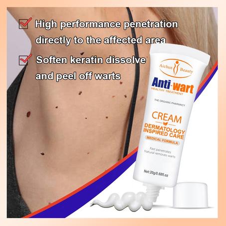 Wart Removal Cream