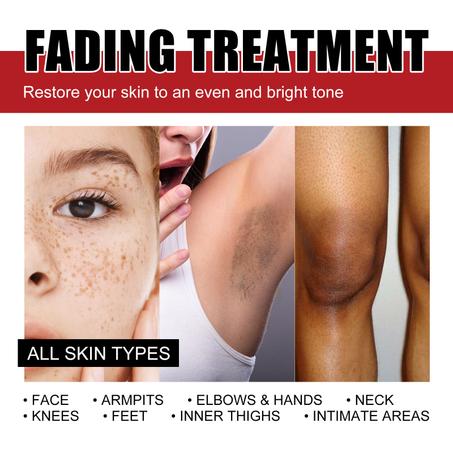 Dark Spots Corrector Cream