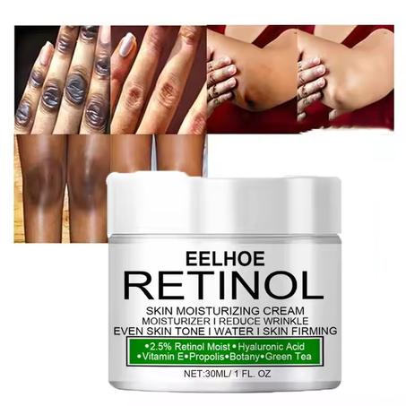 Retinol Moisturizing Cream