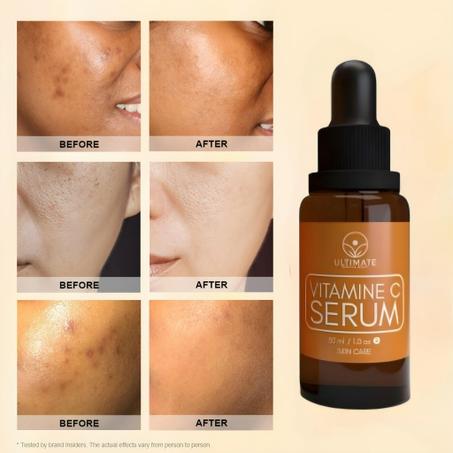 سيروم فتامين C