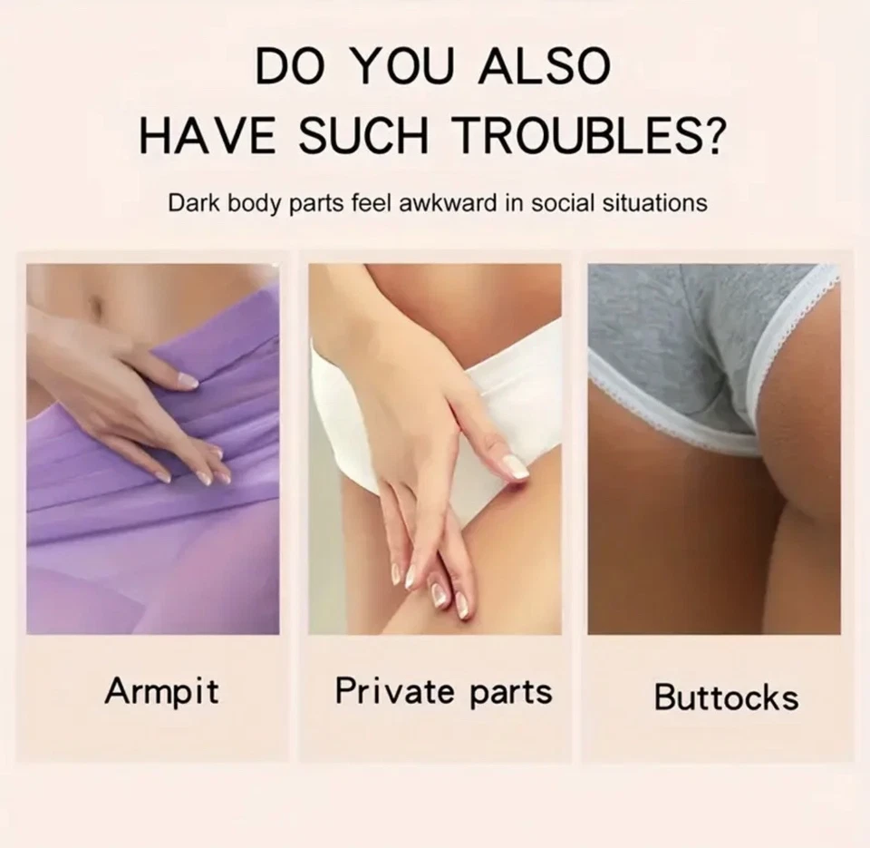 كريم يفتح المناطق الداكنة