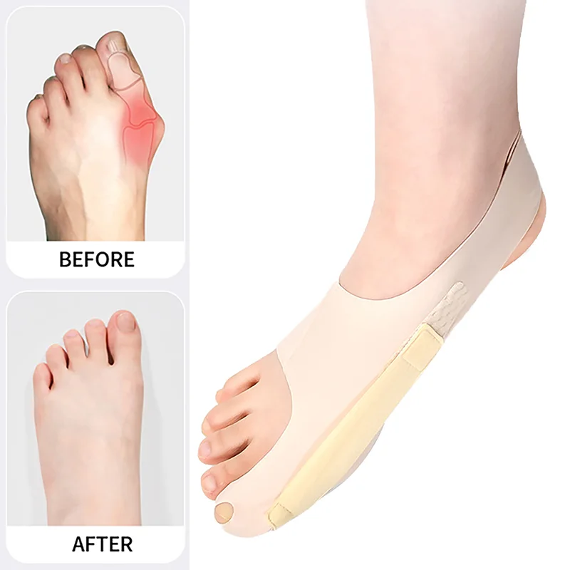Toe Brace C