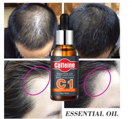 شامبو + زيت مضاد لتساقط الشعر