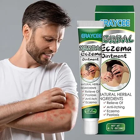 Natural Herb Cream for Eczema