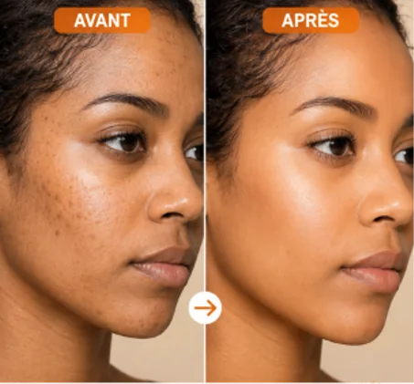 Gmeelan Orange Gel Exfoliant Éclaircissant