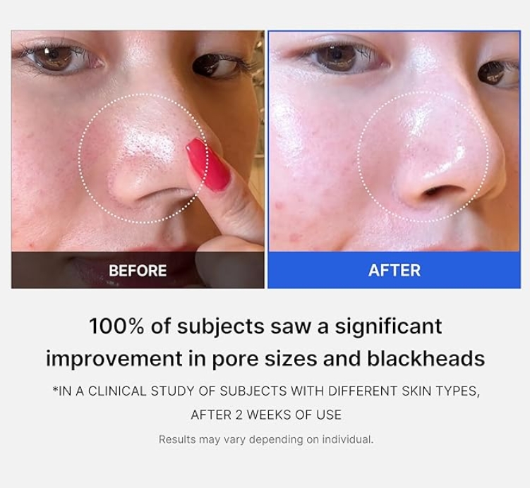 MEDICUBE - Zero Pore Pad 2.0 - 70 pads