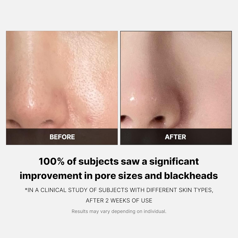 MEDICUBE - Zero Pore Pad 2.0 - 70 pads