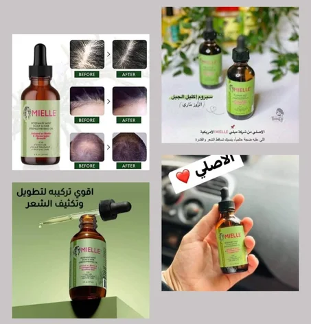 زيت اكليل الجبل لانمو الشعر وتوقف تصاقدة 💯😎