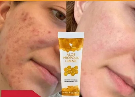Aloe Propolis Crème-الو بروبوليس كريم
