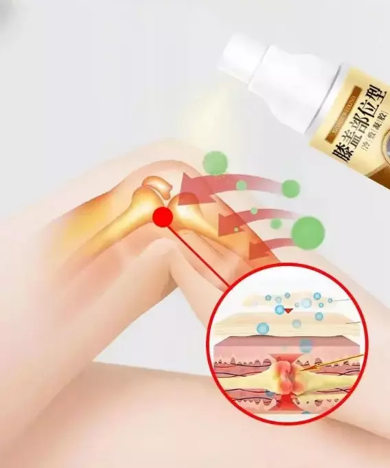 Knee Pain Relief Spray