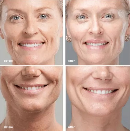 Collagen Face Serum Set - QAT