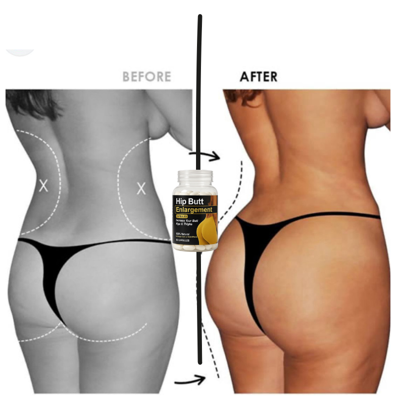 Hip Butt Enlargement Gummies