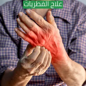 علاج الفطريات