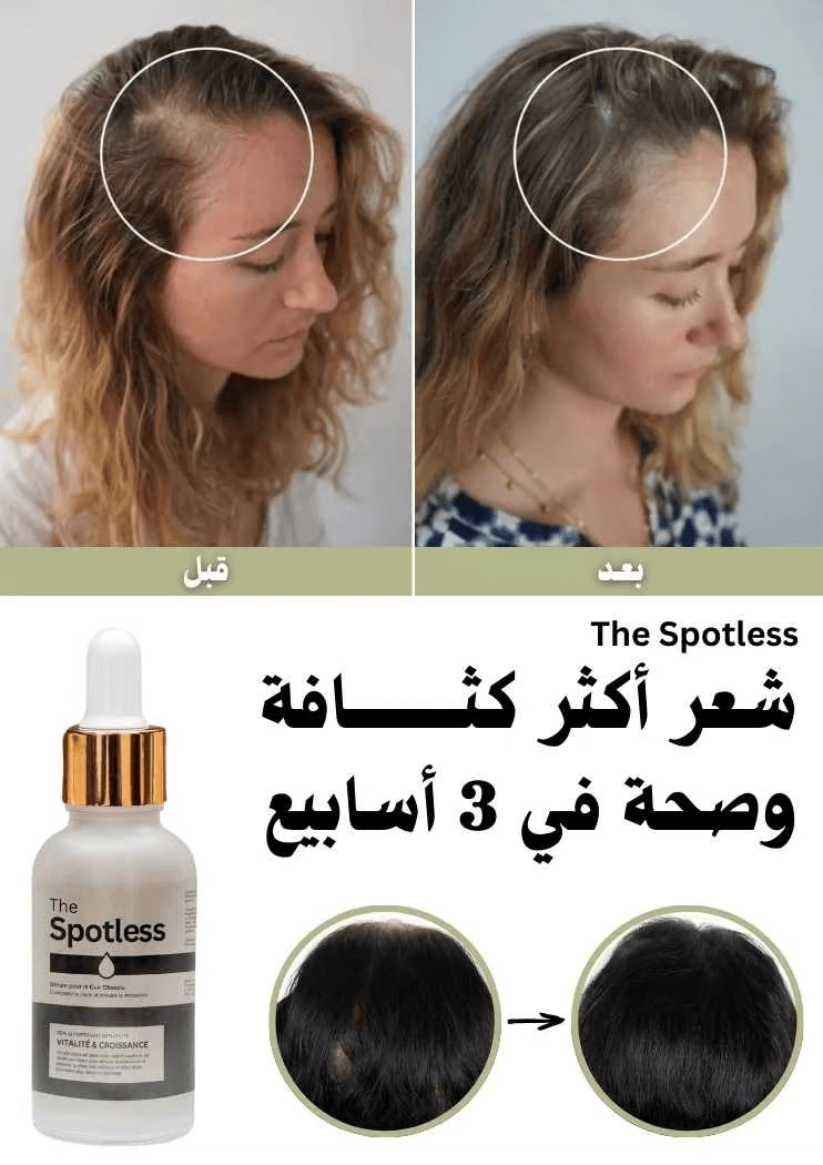Spotlless I4