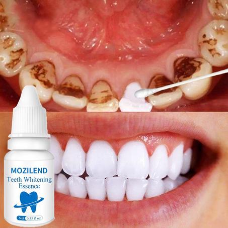 صبغة تبييض الأسنان