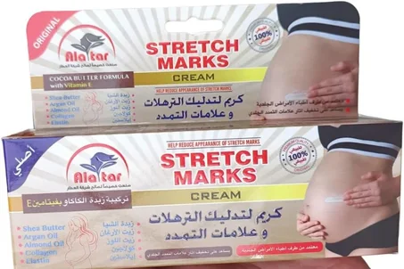 كريم علامات التمدد بزبدة الكاكاو وفيتامين E – بشرة أكثر نعومة!