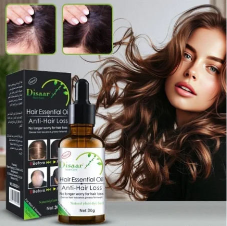 زيت منع تساقط الشعر (30 جم)