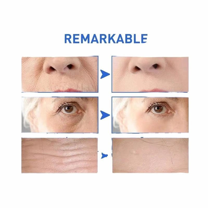 سيروم الكولاجين المضاد للشيخوخة — شد ونضارة فورية