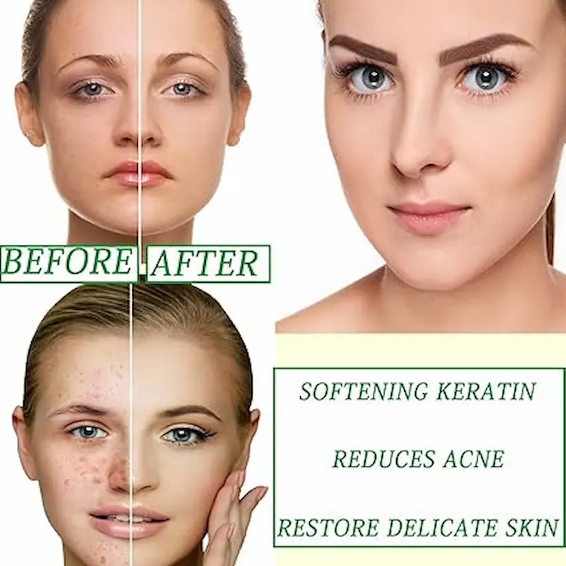 ماسك الوجه بالشاي الأخضر لتنظيف المسامات والتحكم بالدهون