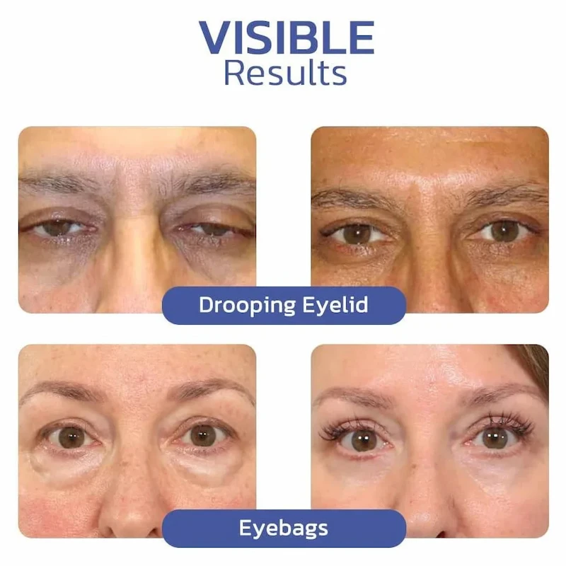 كريم العين لتقليل التجاعيد والهالات الداكنة