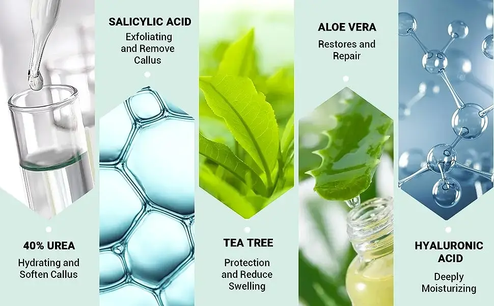 كريم مرطب لليدين والقدمين بحمض الساليسيليك