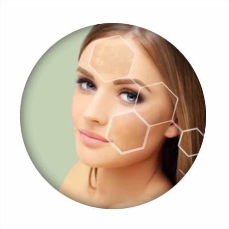 التصبغات وعدم توحّد اللون