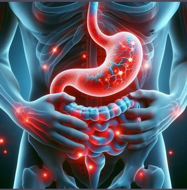 علاج القولون العصبي