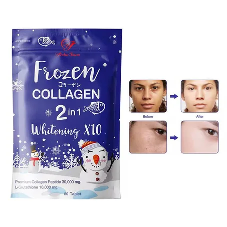 ✨❄️ فروزن كولاجين 2 في 1 – لبشرة بيضاء، صافية ومتوهجة! ❄️✨
