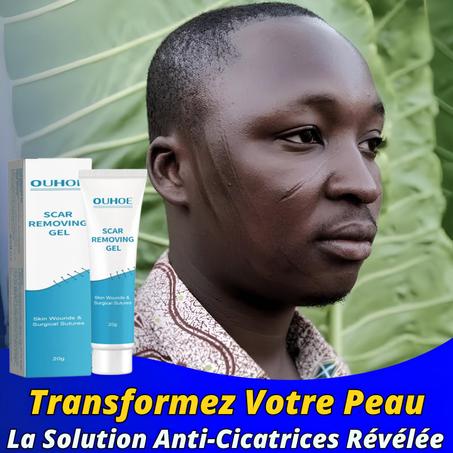 Crème Réparatrice pour L'élimination des Cicatrices et des Taches✨