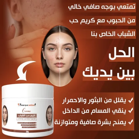 كريم ضد حب الشباب