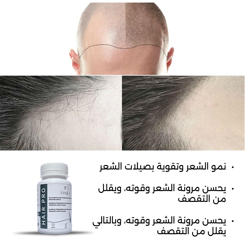 Hair Pro : تعزيز نمو الشعر وتغديته من الداخل