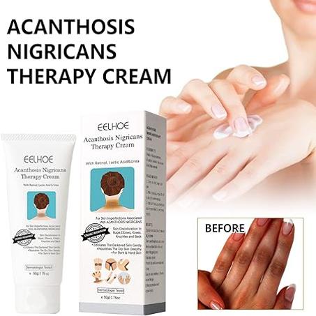 الوصفة السحرية لتفتيح المناطق السوداء