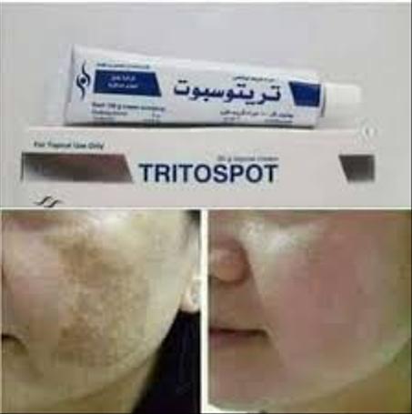 كريم تريتوسبوت لعلاج الكلف و النمش و البقع الداكنة و آثار الحبوب الأصلي
