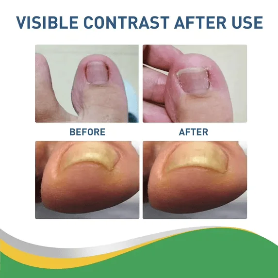 مكونات لاصقة التصحيح