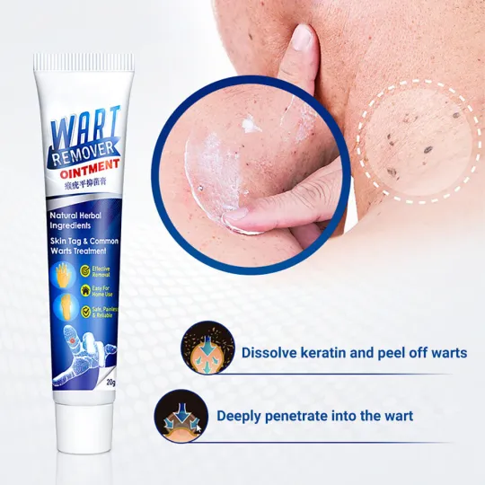 كريم إزالة البُقَع الجلدية