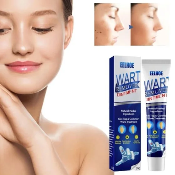 كريم إزالة البُقَع الجلدية