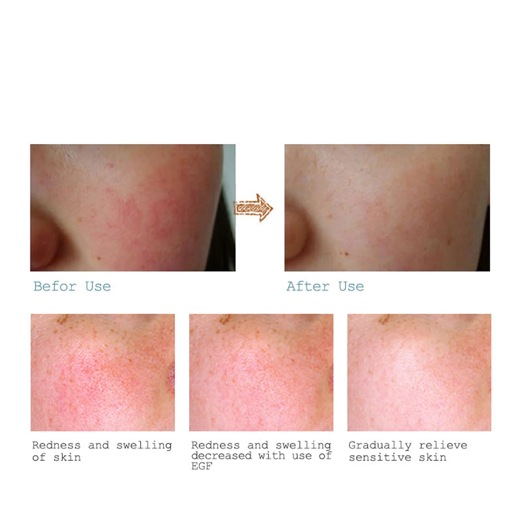 سيروم ماريا لعلاج آثار الحبوب والتجاعيد