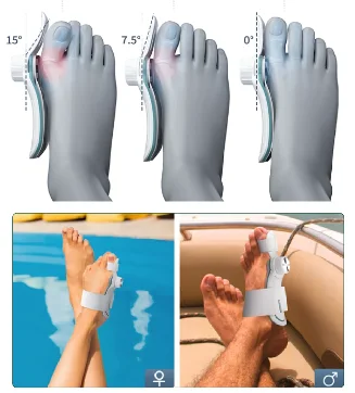 Finger deformity corrector